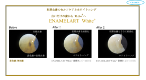 三田市で美歯口 エナメラートホワイトプラスを探すならLuna crescente｜ボディ・オーラルケア